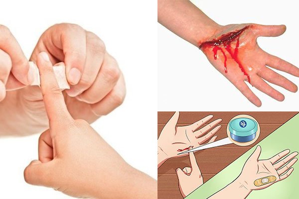 Sơ cứu khi bị đứt tay chảy máu